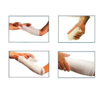 Бинти гіпсові Safix®plus / Сафікс плюс 12см х 3м 2шт, Розмір бинта: 12 см х 3 м, зображення 3