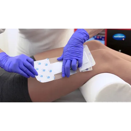 Hydrofilm Plus 9х15см - Повязка пленочная прозрачная с абсорбирующей подушечкой 1 шт, Размер пластыря: 9см х 15см, изображение 5