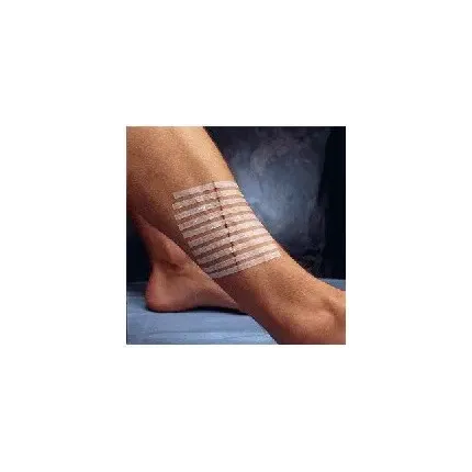 Смужки для безшовного закриття ран Steri-Strip 6х100мм, 10 смужок, Розмір стрічок: 6мм х 100мм, Кількість: 1 шт., зображення 2